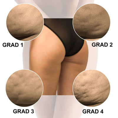 Anti-Cellulite Massagerolle