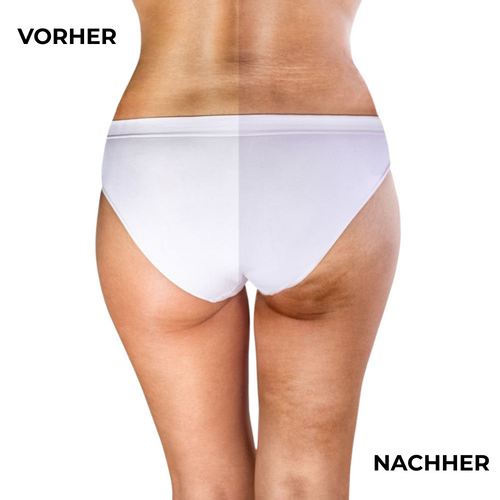Anti-Cellulite Massagerolle